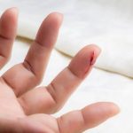 Kerusakan Jaringan Tubuh Atau Luka Akibat Banyak Hal
