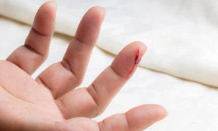 Kerusakan Jaringan Tubuh Atau Luka Akibat Banyak Hal