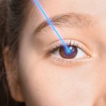 Keadaan Operasi Mata Sebuah Tindakan Lasik